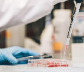 What is a Hemoglobin A1C test?